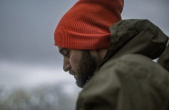 Comment prévenir la calvitie chez un jeune homme (20 ans 30 ans) ?